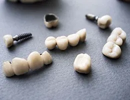 Implant-Retained Crowns and Bridges